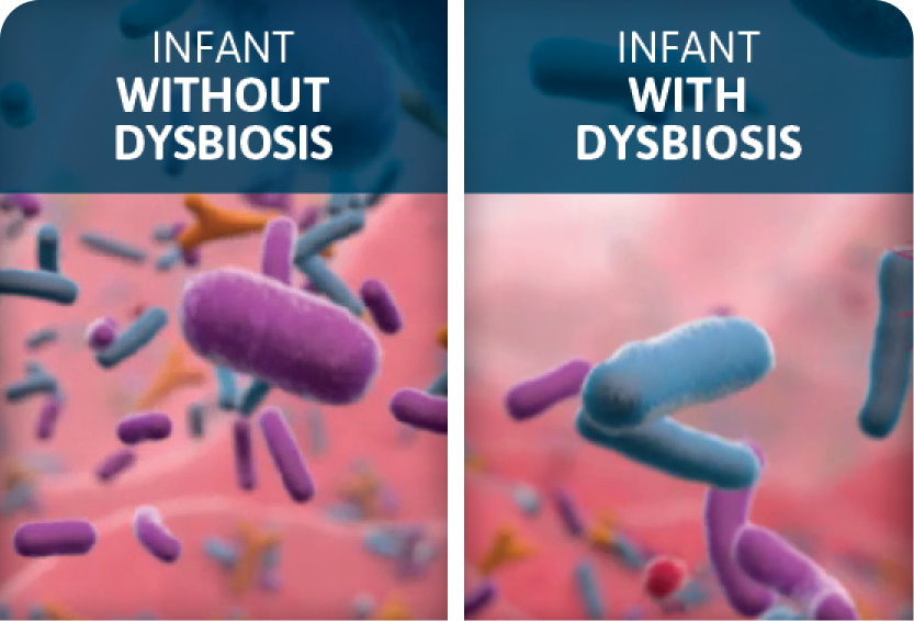 gut microbiota comparison of infant with and without dysbiosis